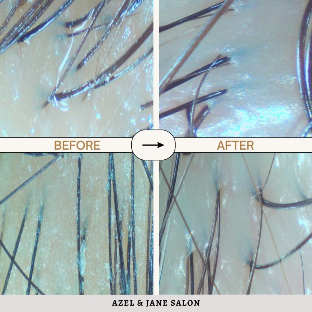 The Benefits of Doing an Oily Scalp Treatment